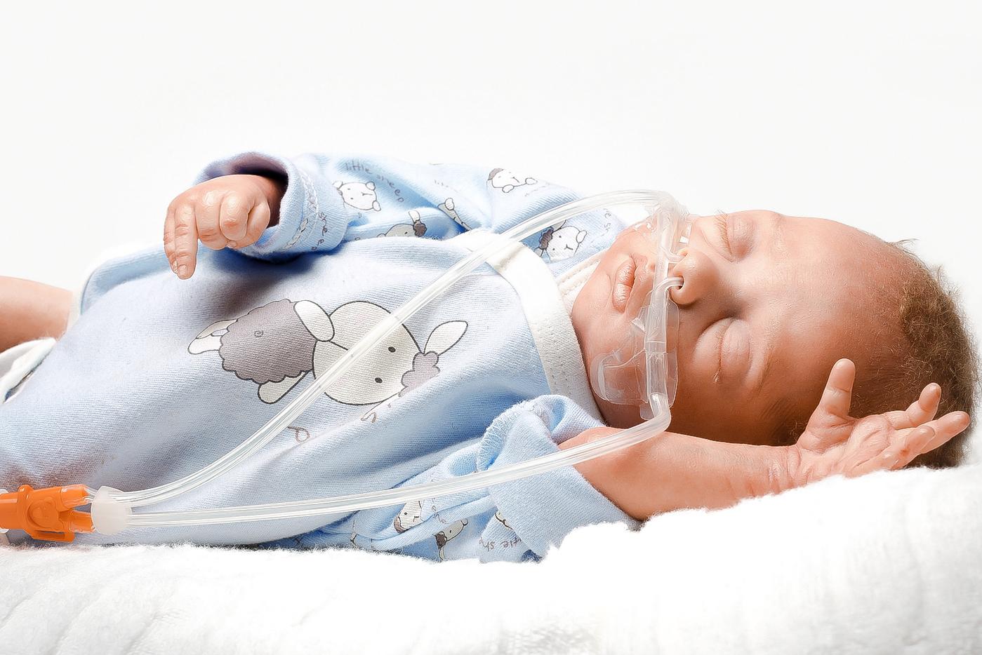 محصولی برای تنفس مصنوعی نوزادان-نازال کانولا نوزاد