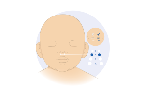 محصولی برای تنفس مصنوعی نوزادان-نازال کانولا نوزاد